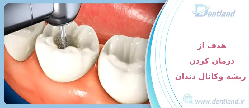 بهترین مواد ضدعفونی کننده کانال دندان